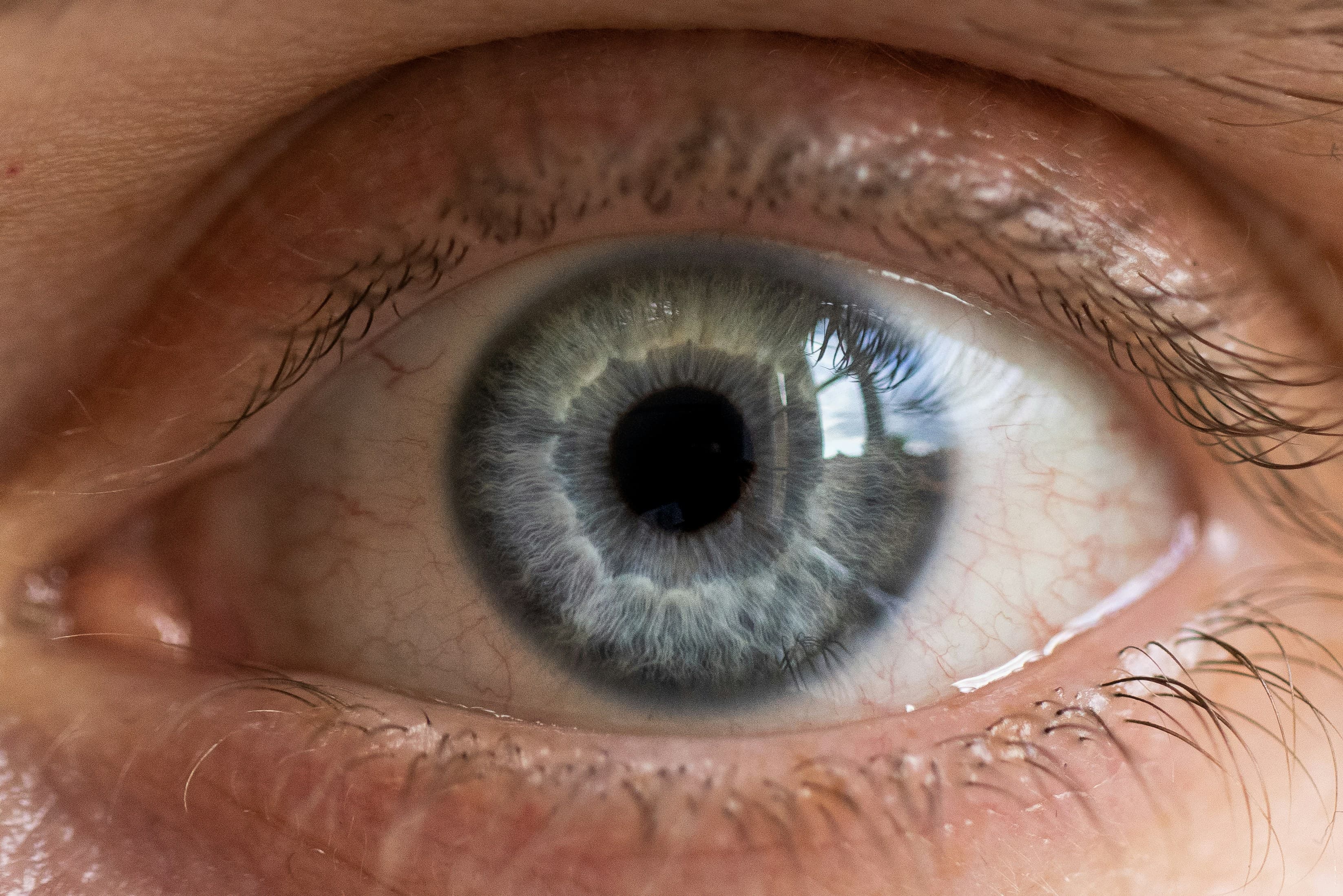 Hazel eye color